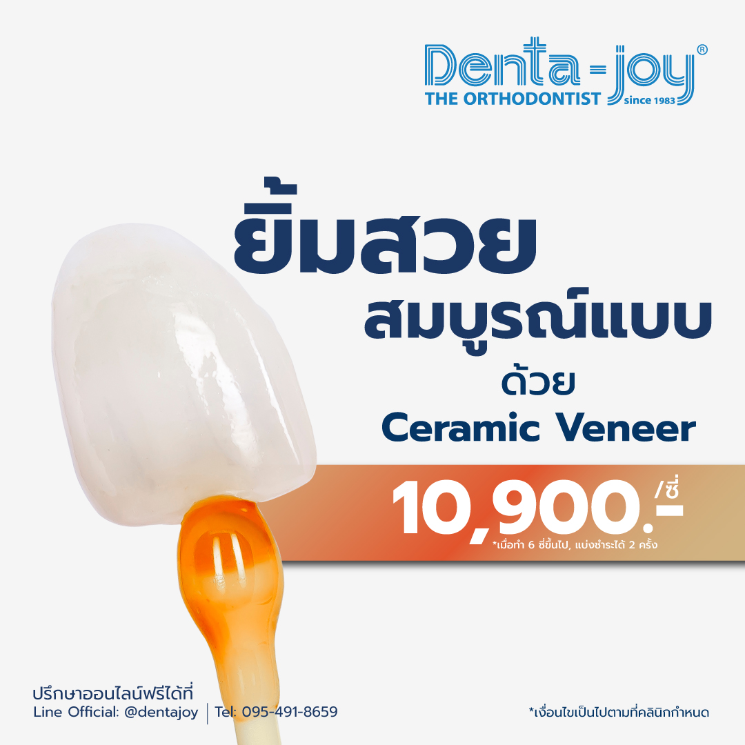 โปรโมชัน Veneer