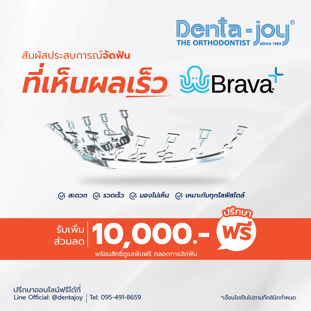 Brava by Brius, promotion, จัดฟันเร็ว