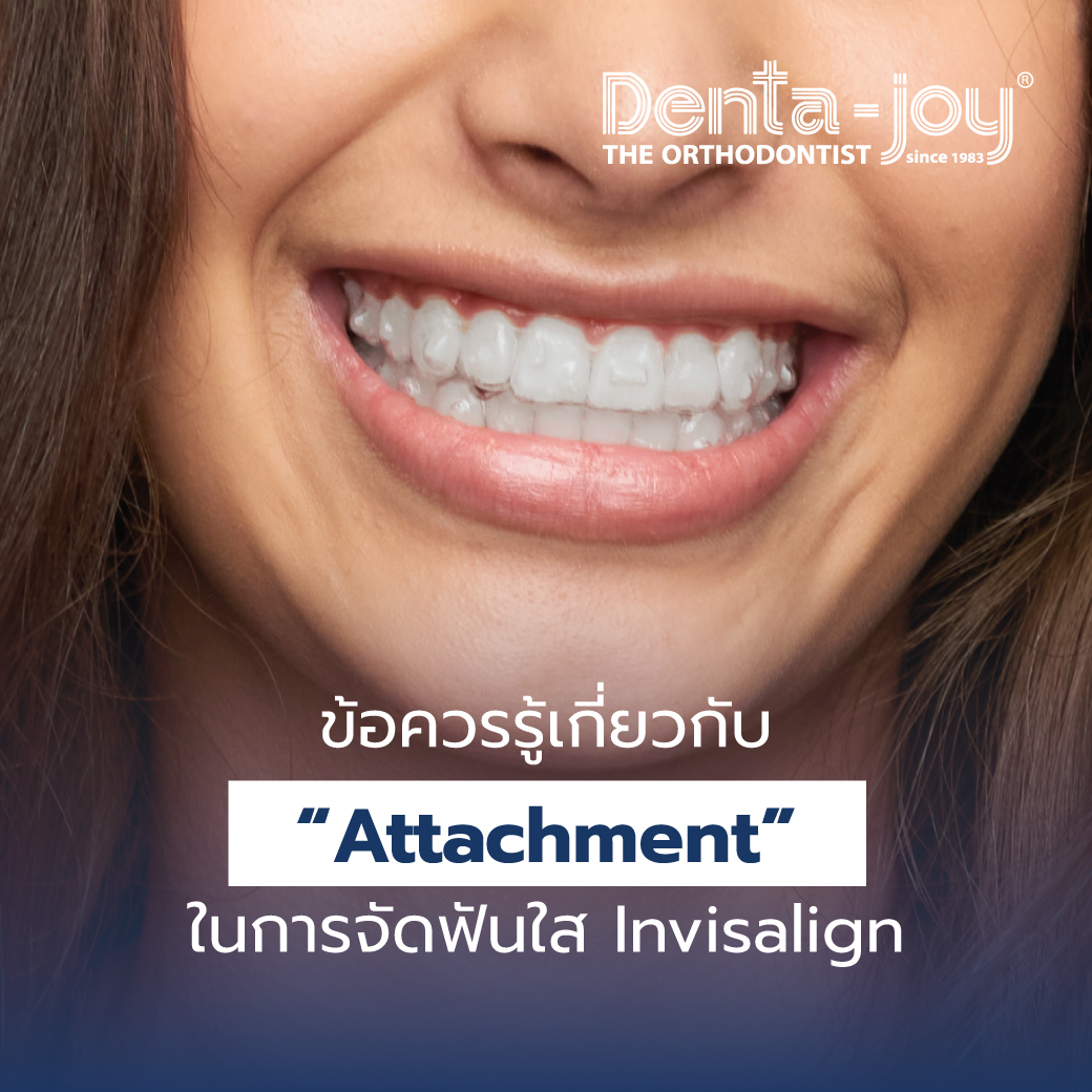 attachment จัดฟันใส