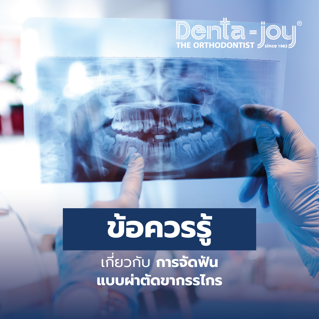 จัดฟันผ่าตัดขากรรไกร