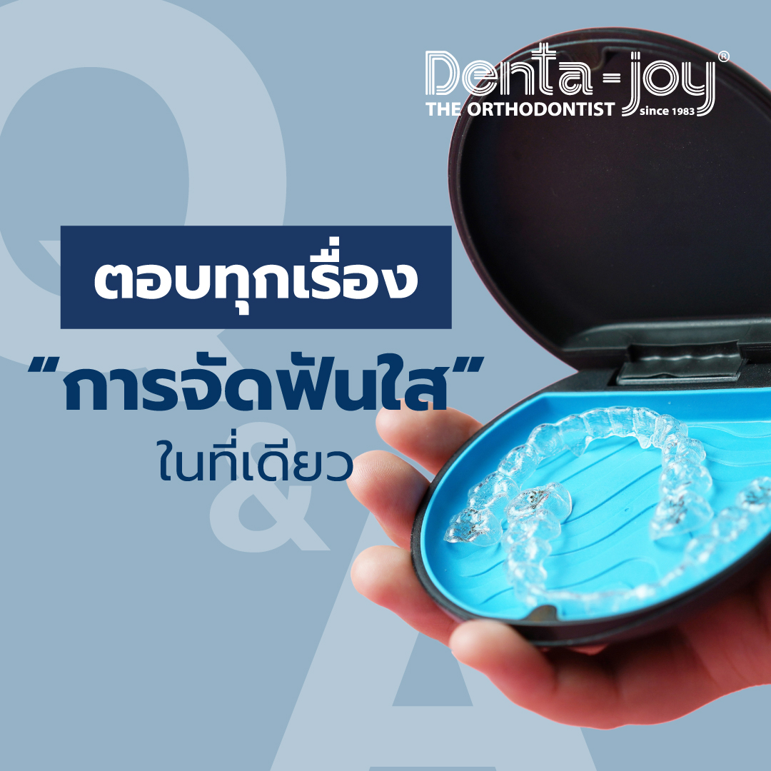 ทุกเรื่องเดี่ยวกับ จัดฟันใส invisalign