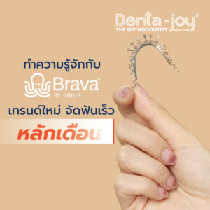 จัดฟัน brava จัดฟันเร็ว