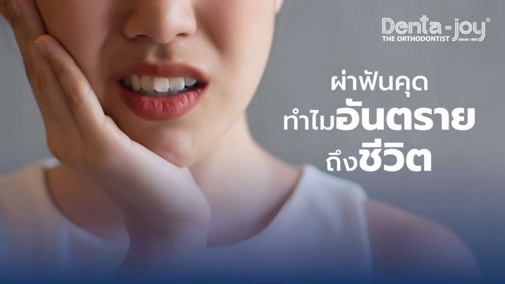 ฟันคุดคืออะไร รู้ว่ามีฟันคุดดูอย่างไร สาเหตุ จำเป็นต้องผ่าฟันคุดหรือไม่ class=