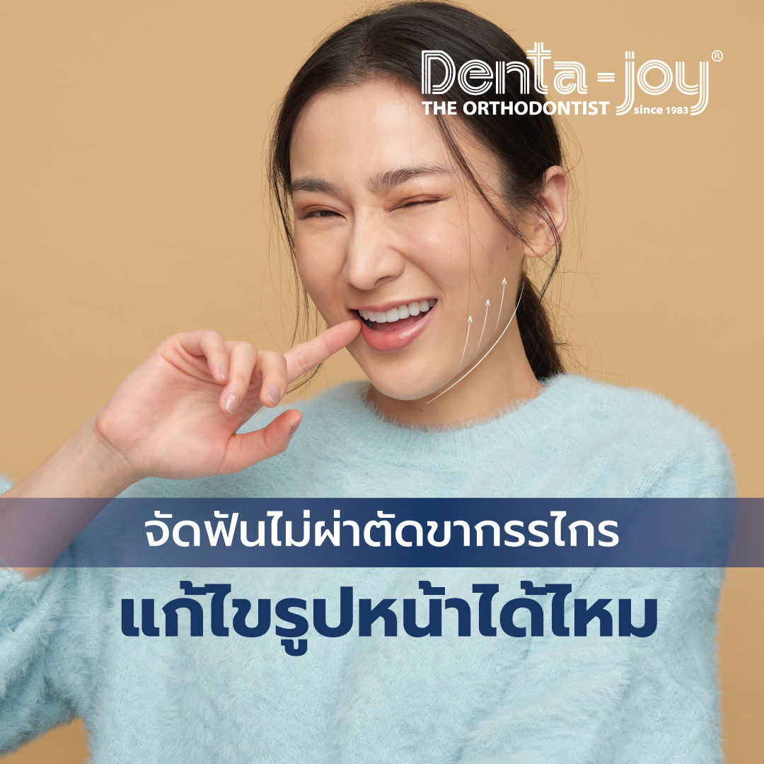จัดฟันไม่ผ่าตัดขากรรไกร เปลี่ยนรูปหน้า