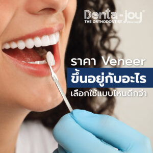 วีเนียร์ veneer