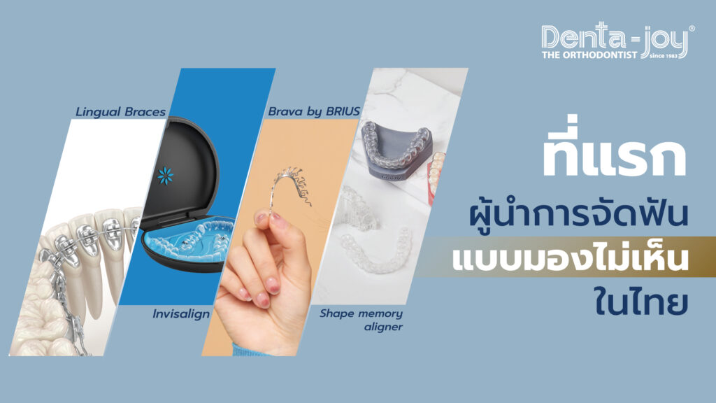 กว่า 41 ปี Dentajoy เดนต้าจอย เป็นผู้นำการจัดฟันแบบมองไม่เห็นที่แรกในประเทศไทย กว่า 40 ปี ตั้งแต่ 1983