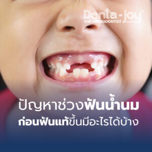 ปัญหาช่วงฟันน้ำนม ก่อนฟันแท้ขึ้นมีอะไรบ้าง