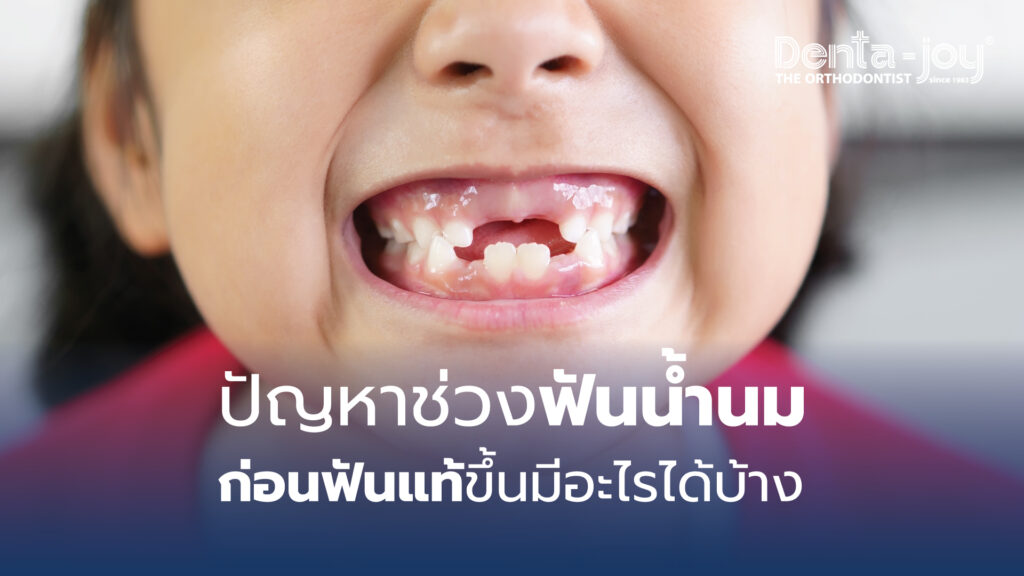 ปัญหาของฟันน้ำนมที่ควรระวังก่อนที่ฟันแท้จะขึ้นมีอะไรบ้าง หน้าที่ของฟันน้ำนม หน้าที่ของฟันแท้ วิธีดูแล