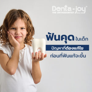 ฟันคุดในเด็ก