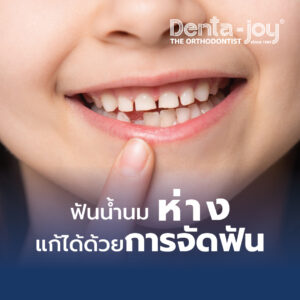 ฟันน้ำนมห่าง จัดฟันในเด็ก