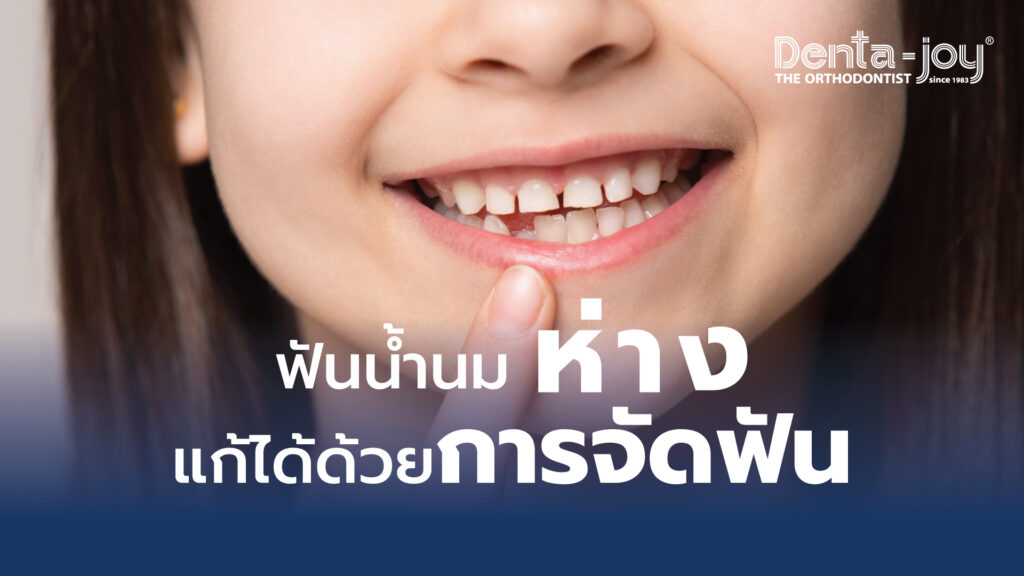 ฟันน้ำนมห่าง