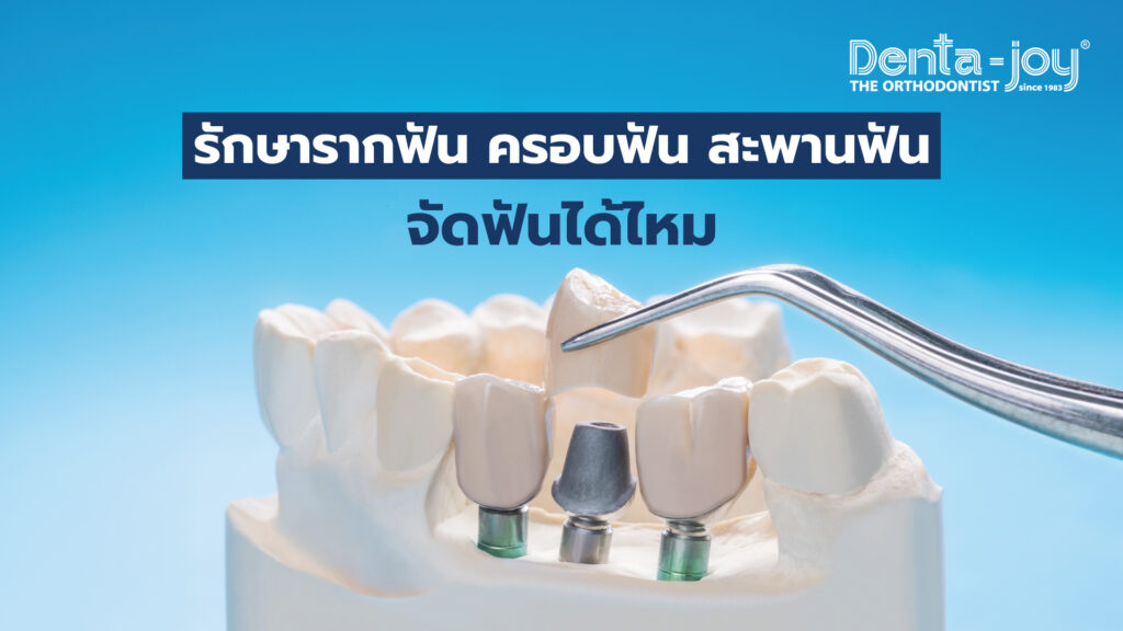 จัดฟันหลังรักษารากฟัน ครอบฟัน สะพานฟัน