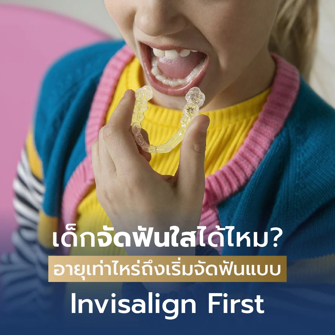 Invisalign First สำหรับเด็กคลินิกจัดฟันใส Denta-joy ทองหล่อ