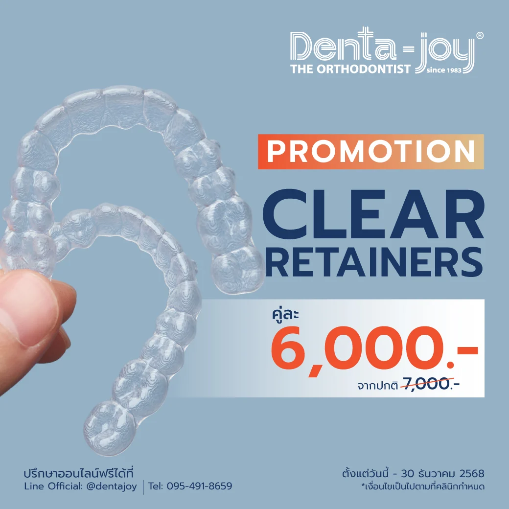 Promotion Retainers