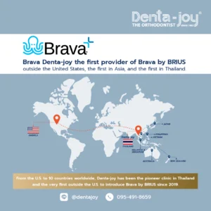 Denta-joy: The First in Asia and Thailand to Introduce Brava by BRIUS Orthodontics