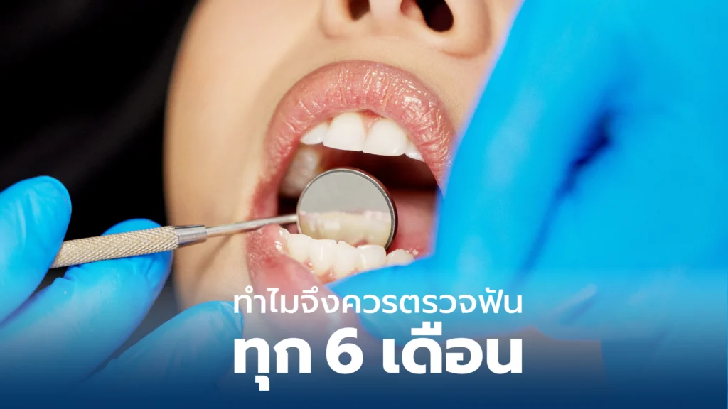 ทำไมจึงควรตรวจฟันทุก 6 เดือน