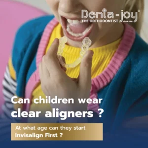 Can children wear clear aligners ?